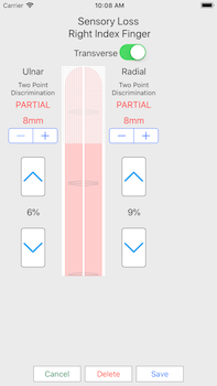 finger selsory loss screen shot